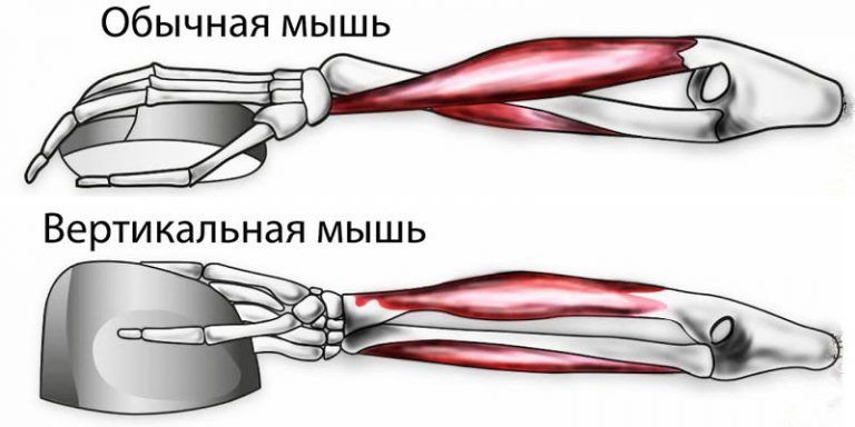 Болит рука от мышки компьютера что делать